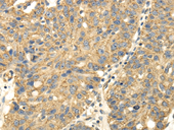 Anti-UHRF1BP1 Antibody