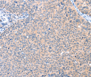 Anti-AADACL2 Antibody