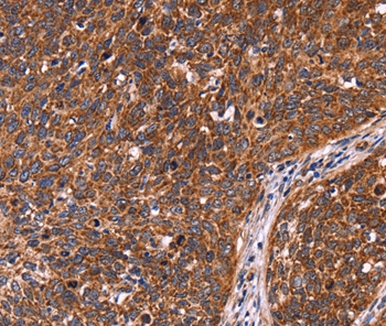 Anti-CCDC106 Antibody
