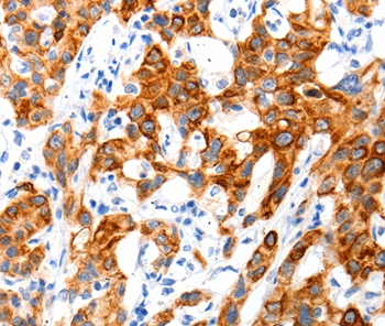 Anti-SLC2A11 Antibody