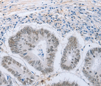 Anti-NEUROG2 Antibody