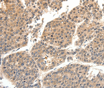 Anti-SLC27A1 Antibody