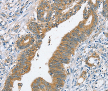 Anti-SLC39A3 Antibody