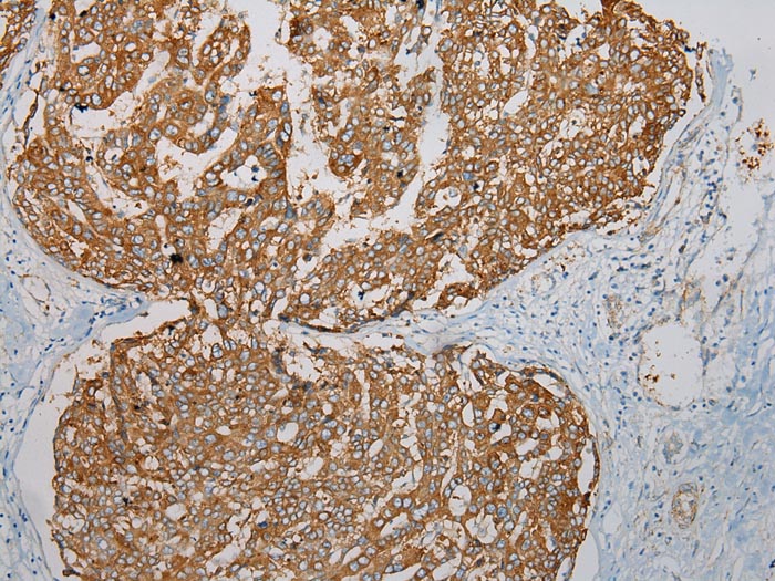 Anti-TMEM123 Antibody
