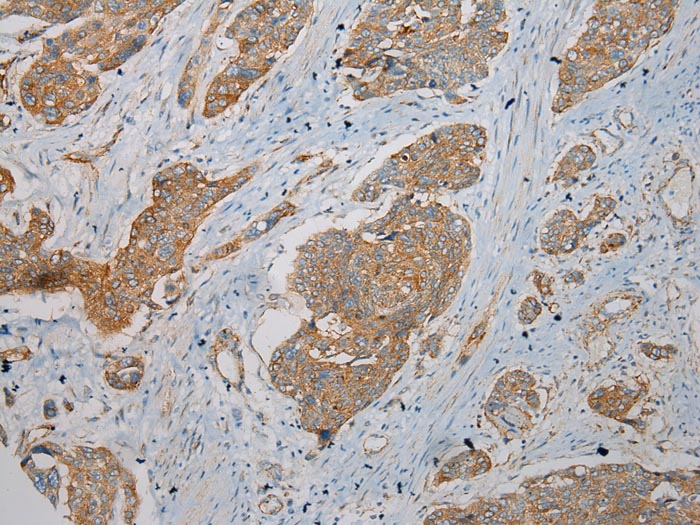 Anti-TMEM123 Antibody Anti-TMEM123 Antibody