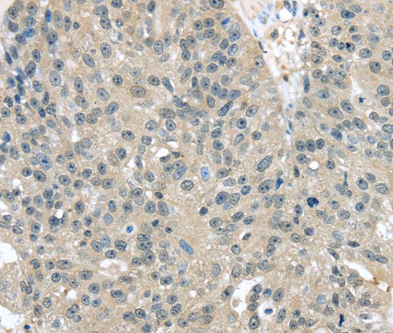 Anti-TXNDC17 Antibody