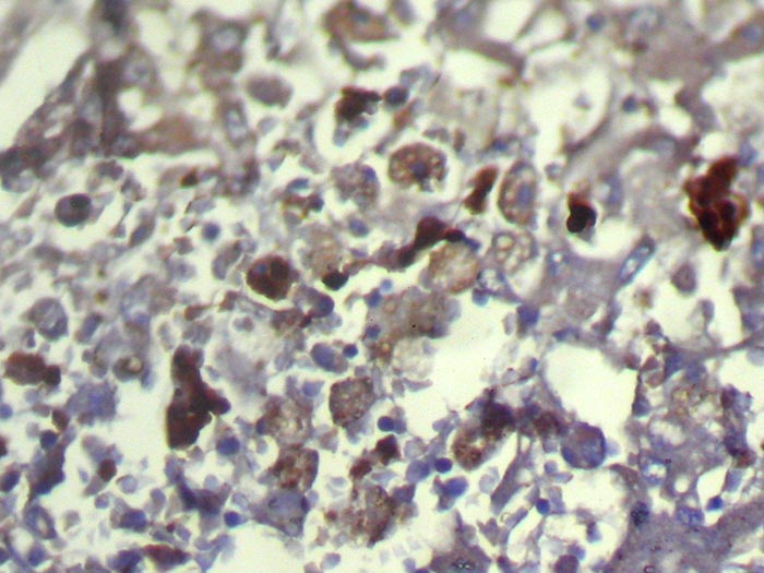 Anti-TXNDC11 Antibody