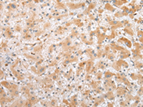 Anti-C1QTNF3 Antibody