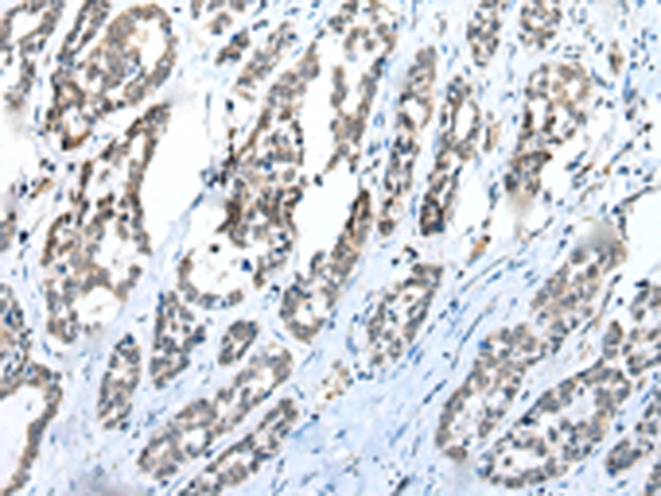 Anti-C1QTNF3 Antibody Anti-C1QTNF3 Antibody