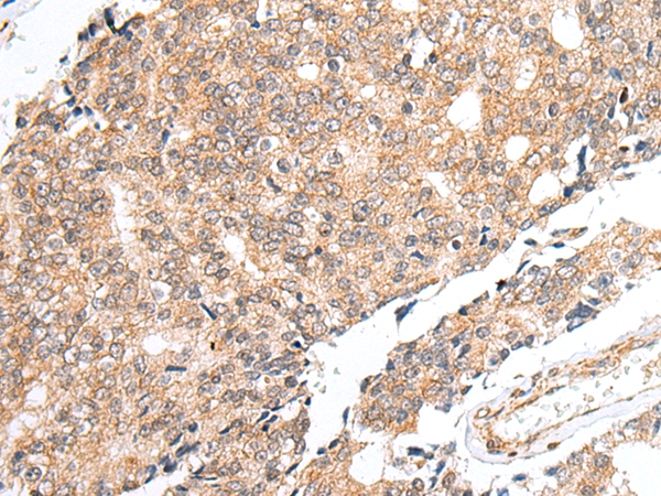 Anti-PRELID1 Antibody