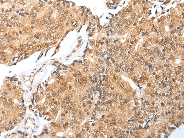 Anti-TRAPPC4 Antibody