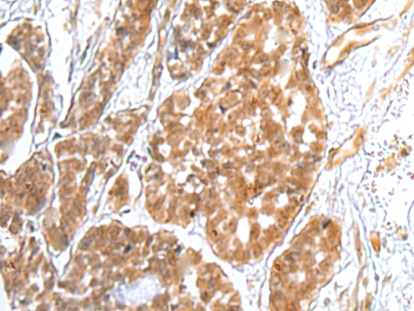 Anti-TRAPPC4 Antibody Anti-TRAPPC4 Antibody