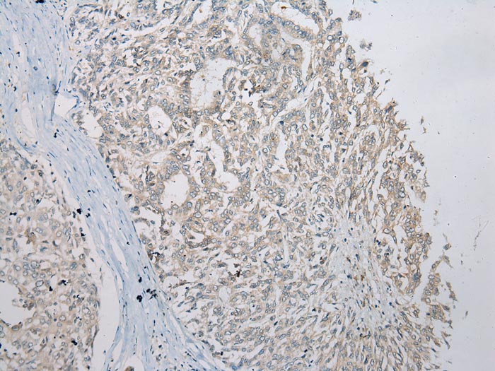 Anti-SLC35E2 Antibody