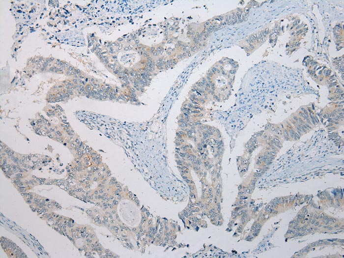 Anti-SLC35E2 Antibody Anti-SLC35E2 Antibody