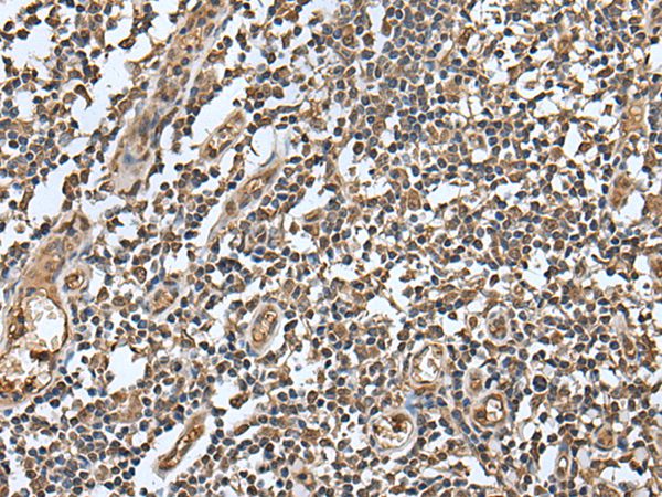Anti-LAMTOR5 Antibody