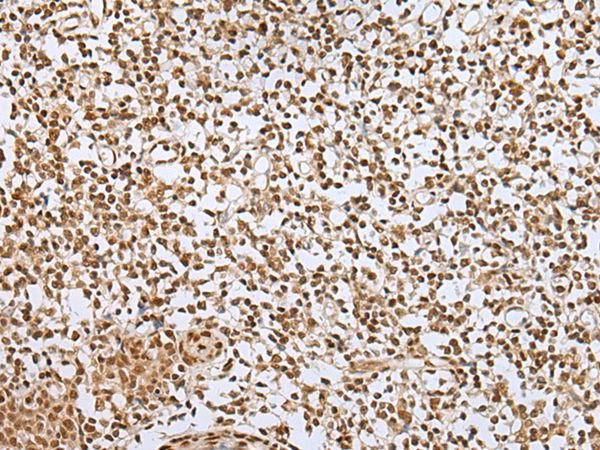 Anti-ZNF354A Antibody