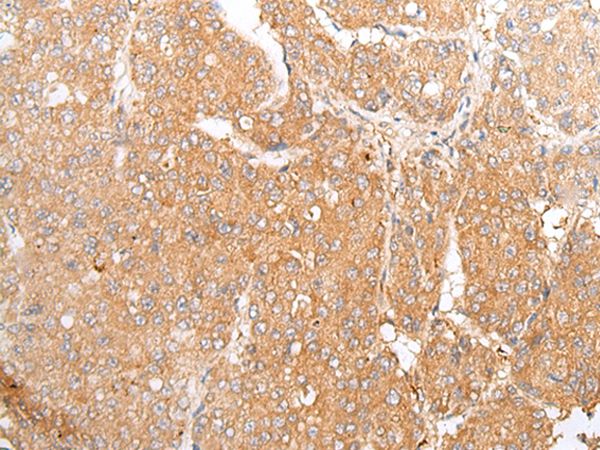 Anti-TMEM107 Antibody