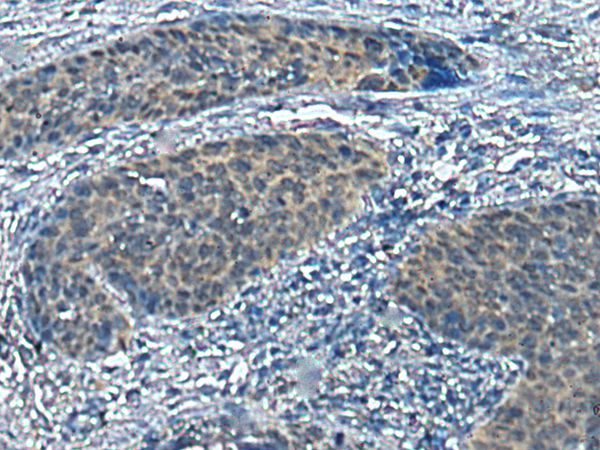 Anti-SLC16A6 Antibody