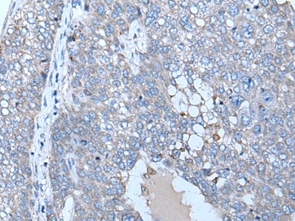 Anti-ZC3HAV1 Antibody