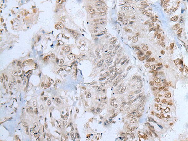 Anti-ZNF143 Antibody
