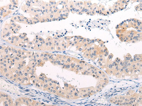 Anti-ANAPC15 Antibody