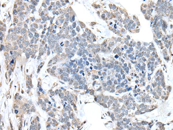 Anti-ANKRD27 Antibody