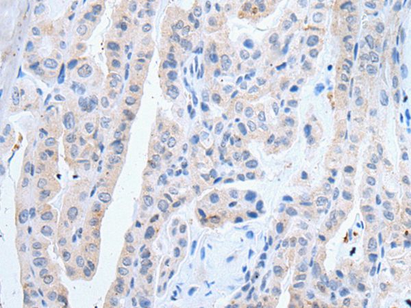 Anti-SLCO2B1 Antibody