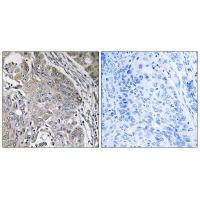 Anti-SPINK6 Antibody