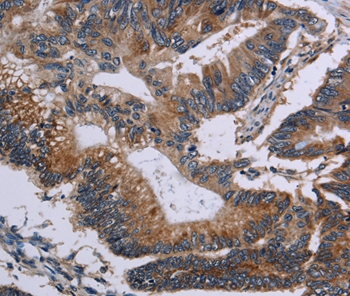 Anti-CLDND1 Antibody