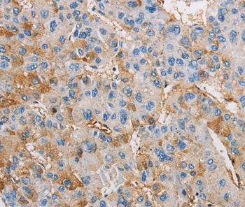 Anti-DIRAS3 Antibody