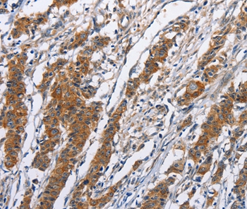Anti-NCAPD3 Antibody