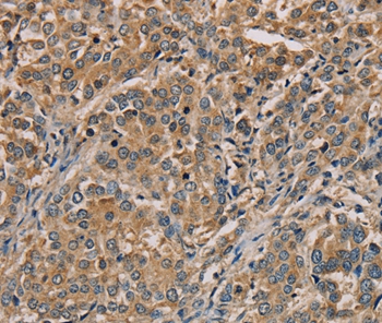 Anti-NANOS2 Antibody