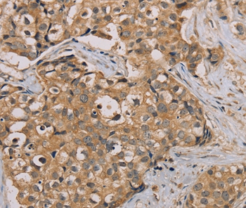 Anti-NANOS2 Antibody Anti-NANOS2 Antibody