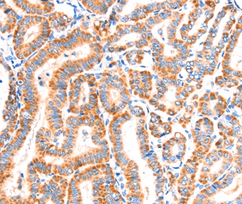 Anti-SCNN1A Antibody