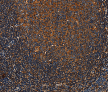 Anti-ANXA2R Antibody