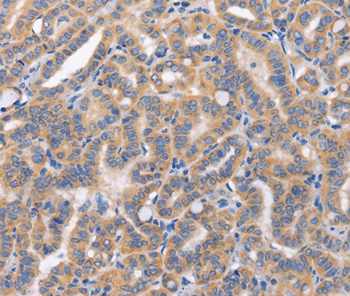 Anti-CARD17 Antibody