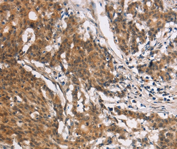 Anti-COL7A1 Antibody