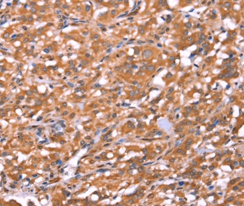 Anti-FAM13B Antibody