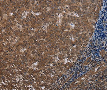 Anti-FOLH1B Antibody