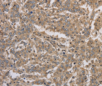 Anti-KCNMB3 Antibody