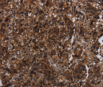 Anti-MAGEE1 Antibody