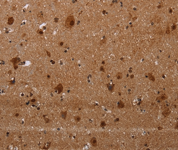 Anti-MAGEE1 Antibody Anti-MAGEE1 Antibody