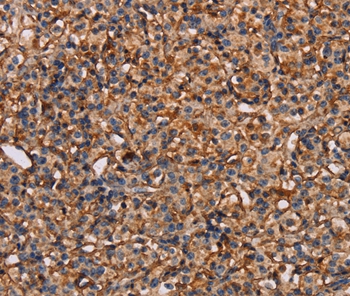 Anti-PLXNA1 Antibody