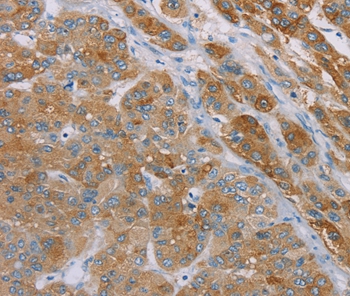 Anti-SAMD4A Antibody