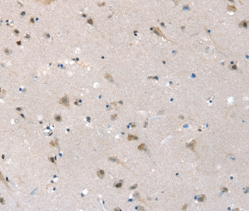 Anti-SLC6A7 Antibody