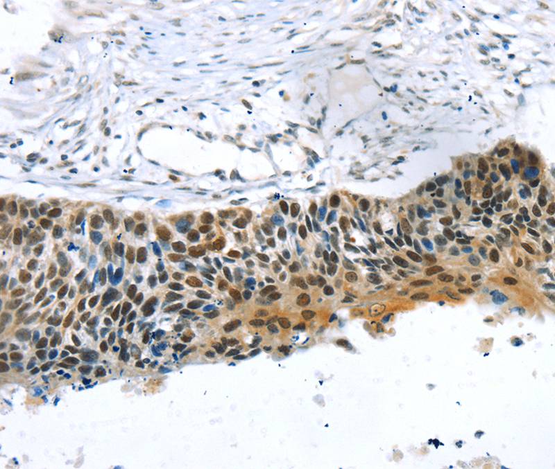 Anti-TRERF1 Antibody