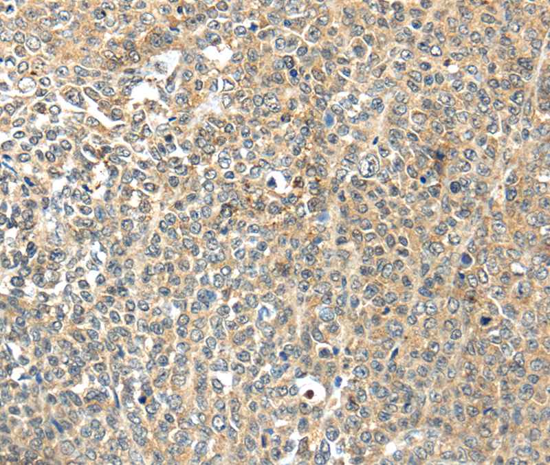 Anti-TSPYL6 Antibody