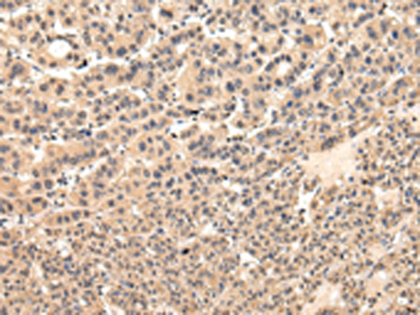 Anti-VPS37D Antibody