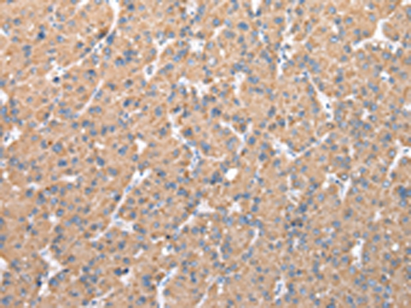 Anti-CFAP52 Antibody