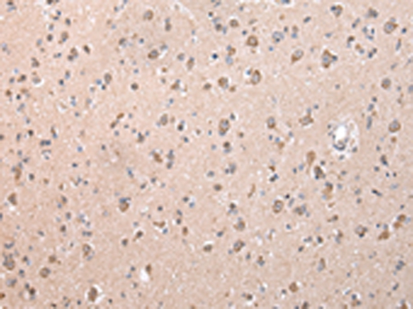 Anti-ZCCHC9 Antibody